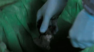 Still from Hippocratic Oath (2)