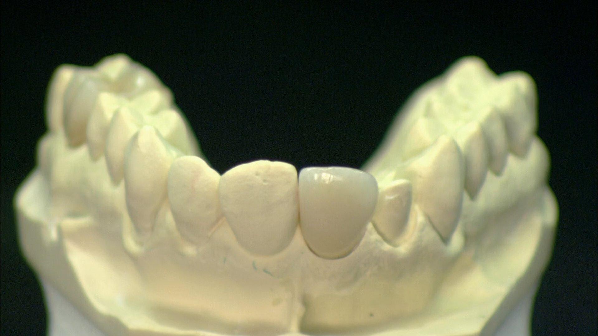 Still from Kelp Caviar, Luxury Sailboats, Dental Crowns, High-Performance Engines