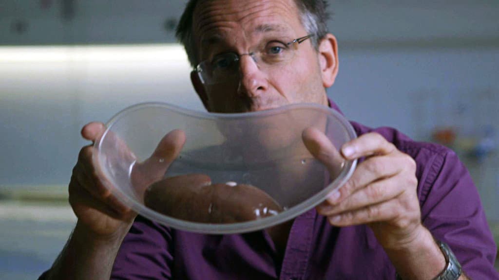 Still from Mend Me: A Horizon Guide to Transplants